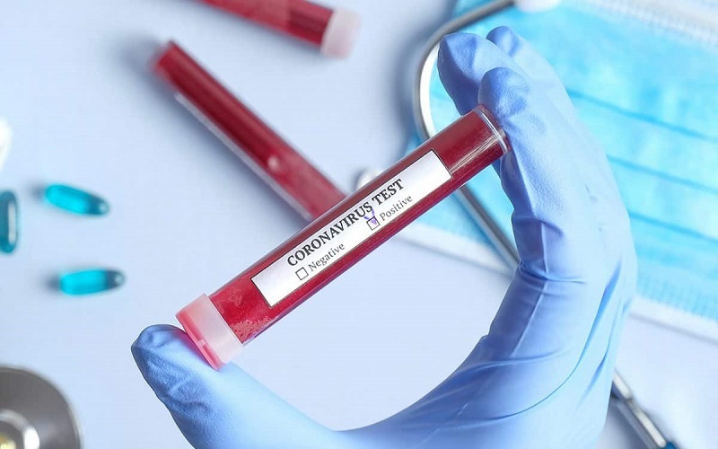 1.736 de cazuri noi de Covid-19 și 25 de decese au fost înregistrate. Peste 8 mii de persoane se tratează la domiciliu