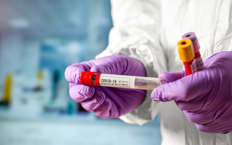 329 de persoane au fost testate pozitiv la Covid-19, iar alte 17 au decedat din cauza virusului