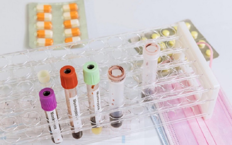 Al doilea caz de variola maimuței, confirmat