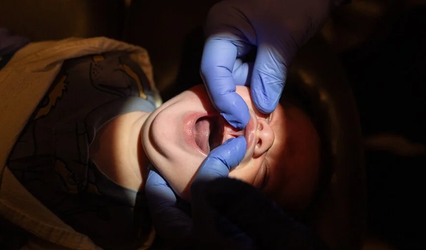 Afacerea profitabilă a doctorilor - Detaliile din spatele operațiilor de tăiere a limbilor la sugari