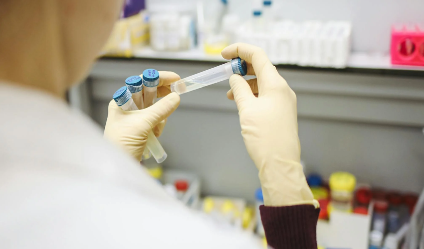 Virusul HIV poate fi eliminat din celule, spun oamenii de știință