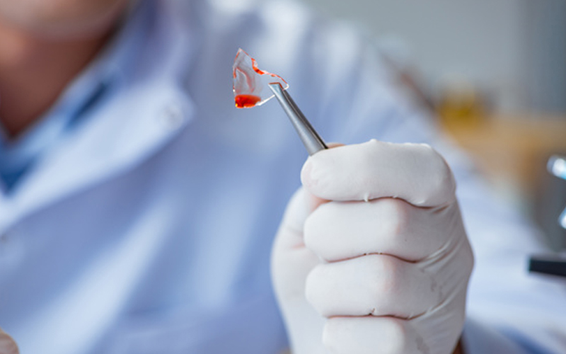 Medicament revoluţionar împotriva cancerului, în ultima etapă de analiză. Va putea trata mai multe tipuri de cancer, inclusiv de plămâni