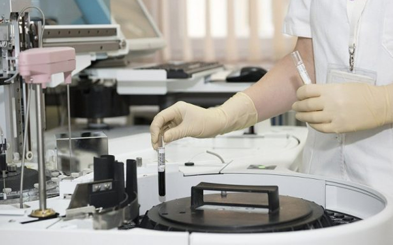 OFICIAL 35 de cazuri de coronavirus în România