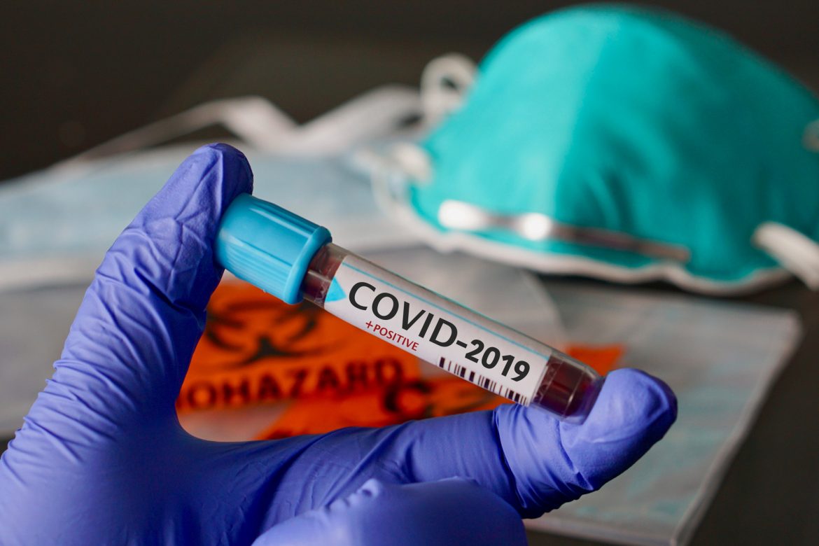 „Nu recomandăm aceste pseudo-teste”. Ministrul Sănătății, despre testele rapide pentru COVID-2019 care se fac în sistemul medical privat