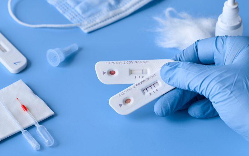 COVID-19: тест на антитела — что это такое, когда проводится и что показывает