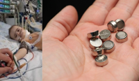 Povestea lui Marcu, un băiețel care a supraviețuit după ce a înghițit o baterie