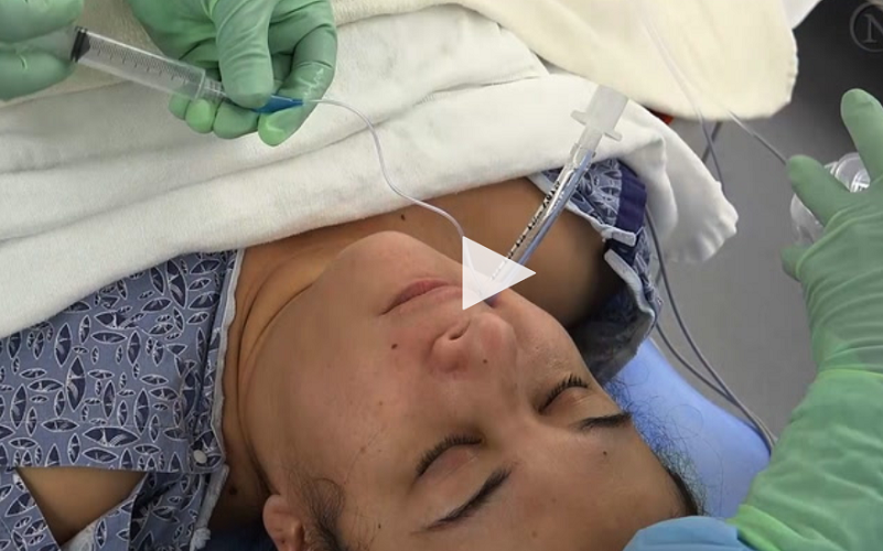 VIDEO/ Intubarea de urgență în Covid-19