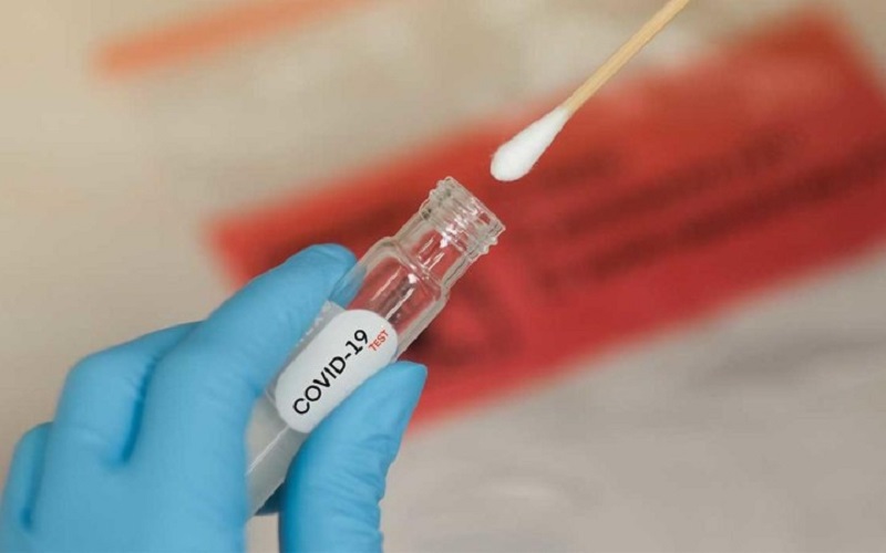 Testele PCR pentru depistarea COVID se ieftinesc: 300 lei pentru o analiză, în loc de 755