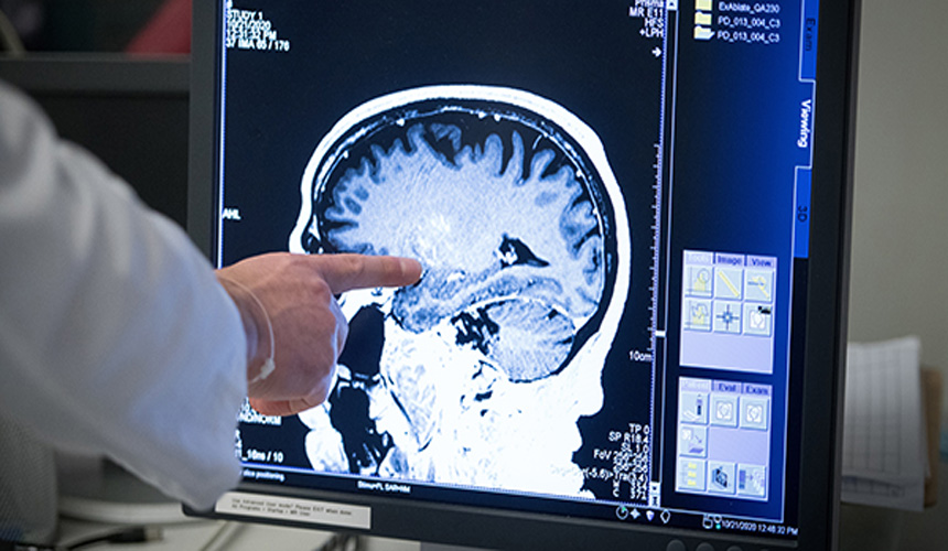 Simptomele bolii Parkinson pot fi ameliorate cu ajutorul ultrasunetelor focalizate
