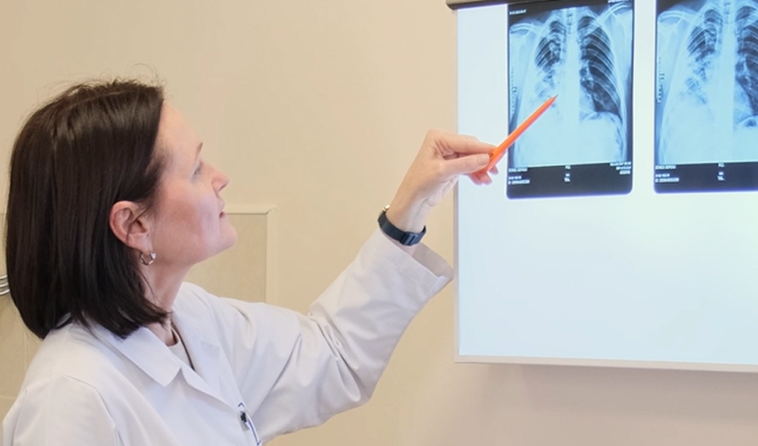 De ce este important ca tratamentul tuberculozei să fie urmat până la capăt