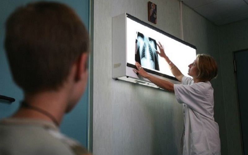 România va avea în sfârșit o lege a tuberculozei