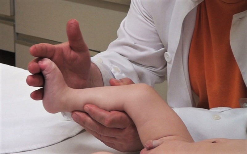 Tot mai mulți copii sunt diagnosticați prea târziu cu displazie de șold, în pofida screening-urilor care se fac. „Procentul este inacceptabil de mare”